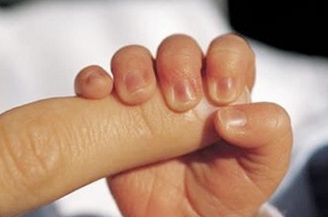 aborto2011-11