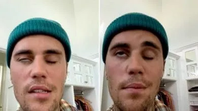 Justin Bieber sufre una paralisis facial y pide oración